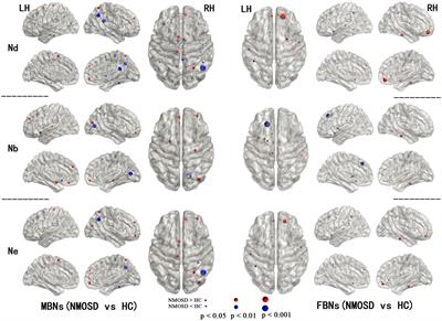 In patients with mild disability NMOSD: is the alteration in the cortical morphological or functional network topological properties more significant